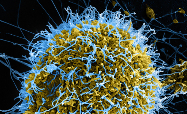 Electron Micrograph of Ebola Virus